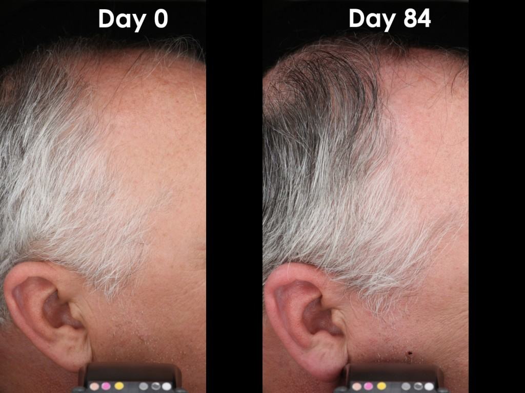 nutrastim-hair loss (4)